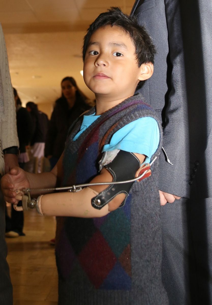 DIF Prótesis 130619 (2)