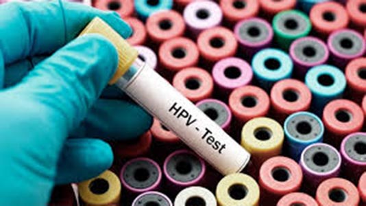 virus papiloma humano