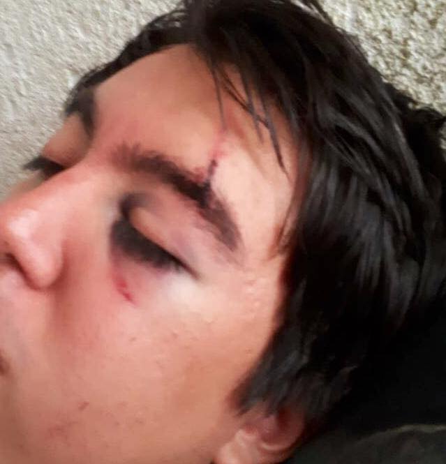 pasajero uber golpeado