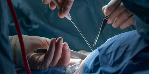 vasectomía sin bisturí