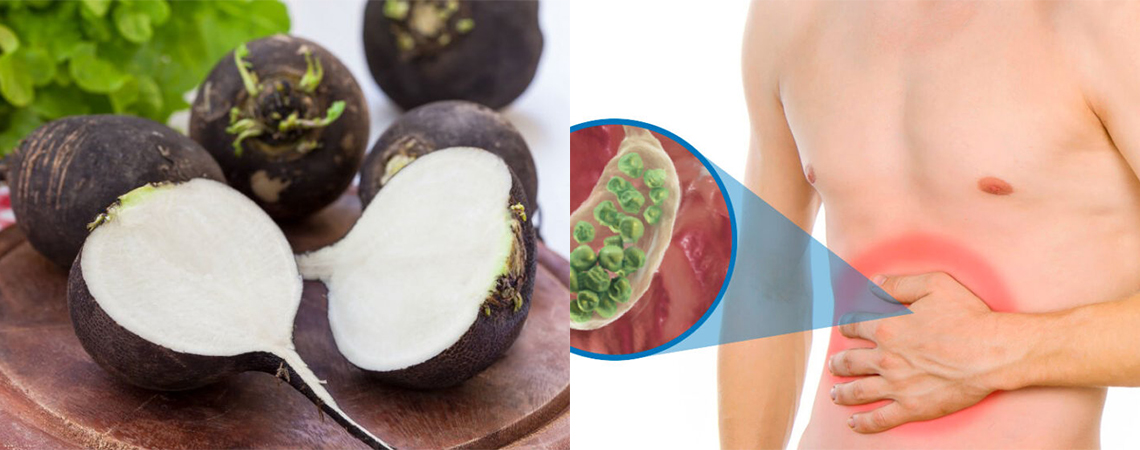 cálculos - biliares- rábano negro