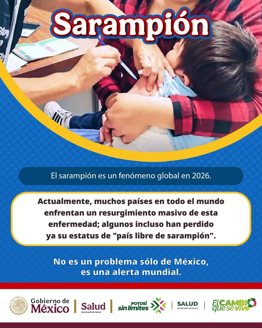 sarampión
