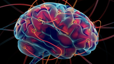 enfermedad de hungtinton