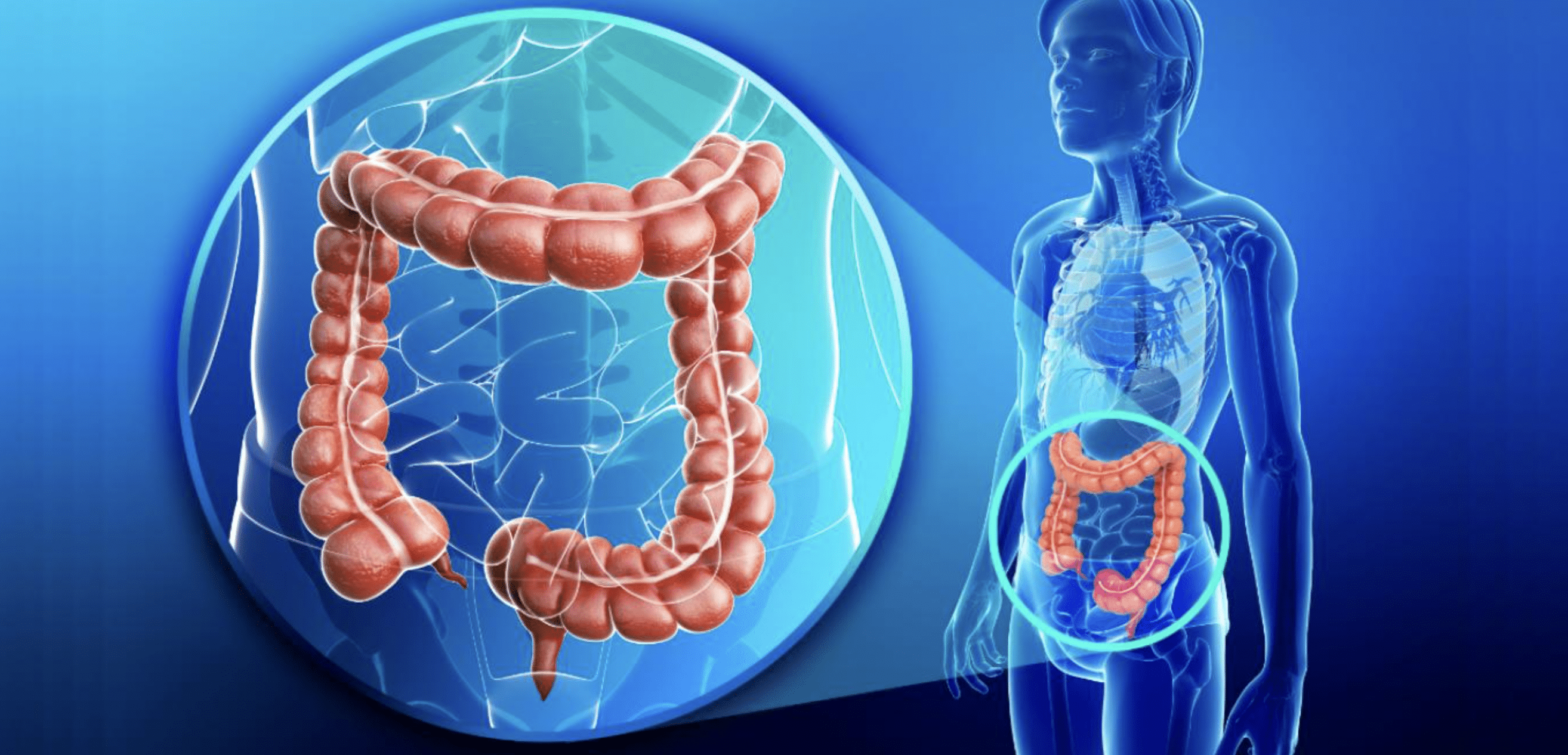 día mundial cáncer de colon