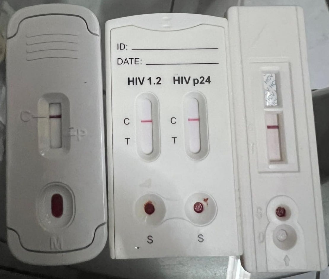 servicios de salud pruebas vih