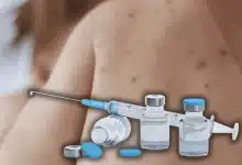 ops sarampión salud